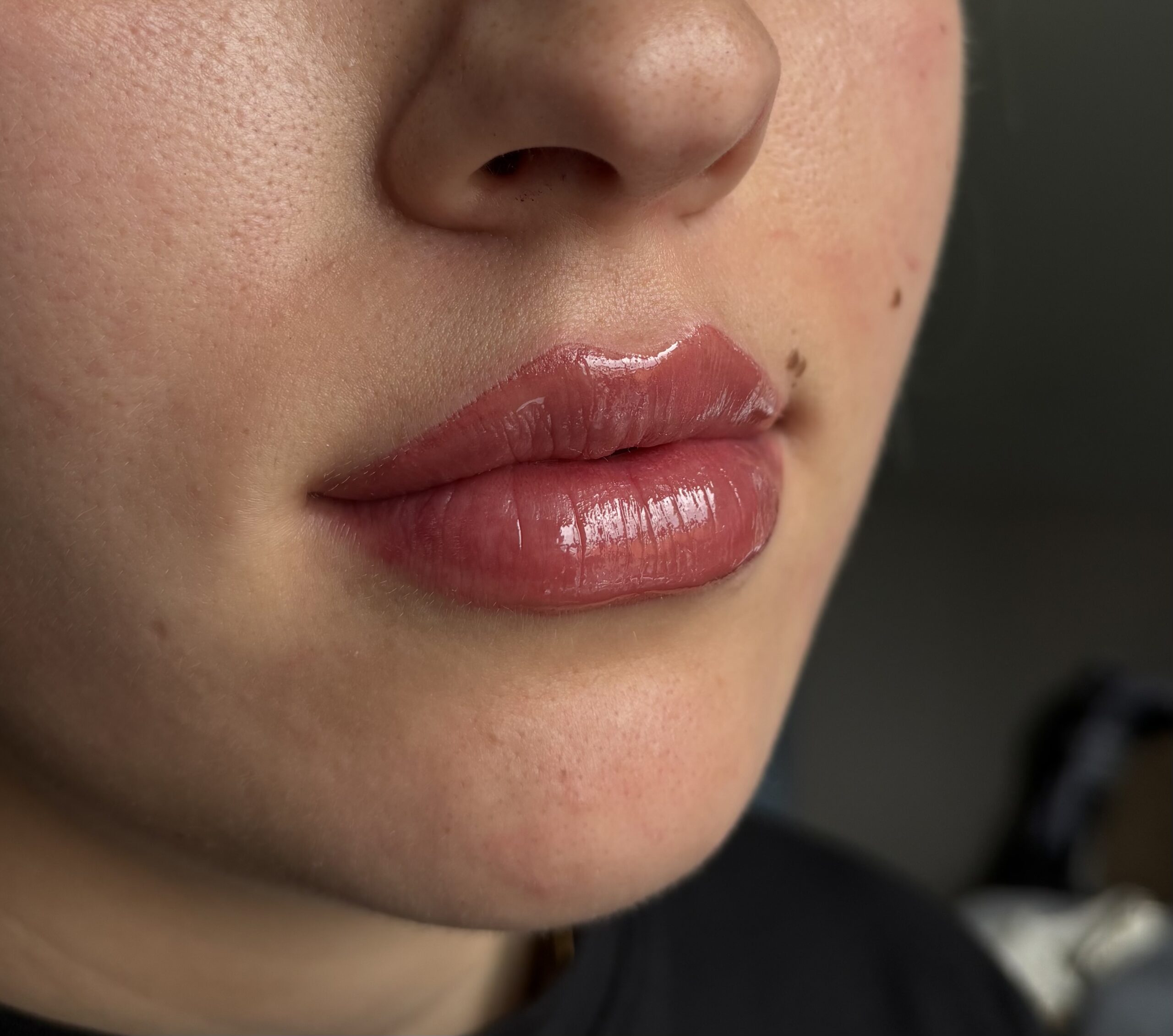 Resultaat van een lip blush behandeling
